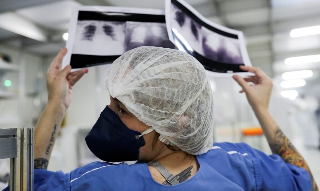 Câncer de pulmão: 90% dos diagnósticos no SUS chegam em fase avançada, alertam especialistas