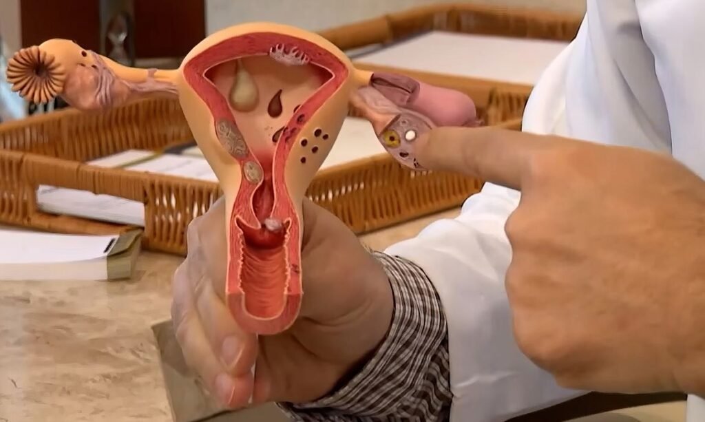 Investimento de R$ 60 milhões impulsiona pesquisas sobre endometriose e saúde menstrual no Brasil