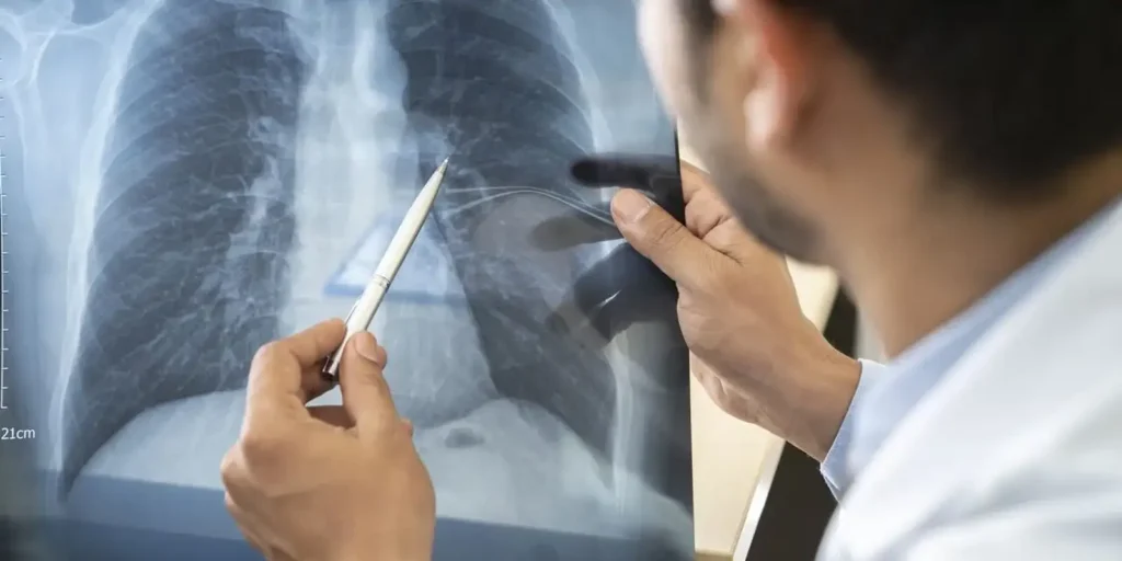 Tabagismo atinge patamar preocupante entre jovens brasileiros de 16 a 24 anos