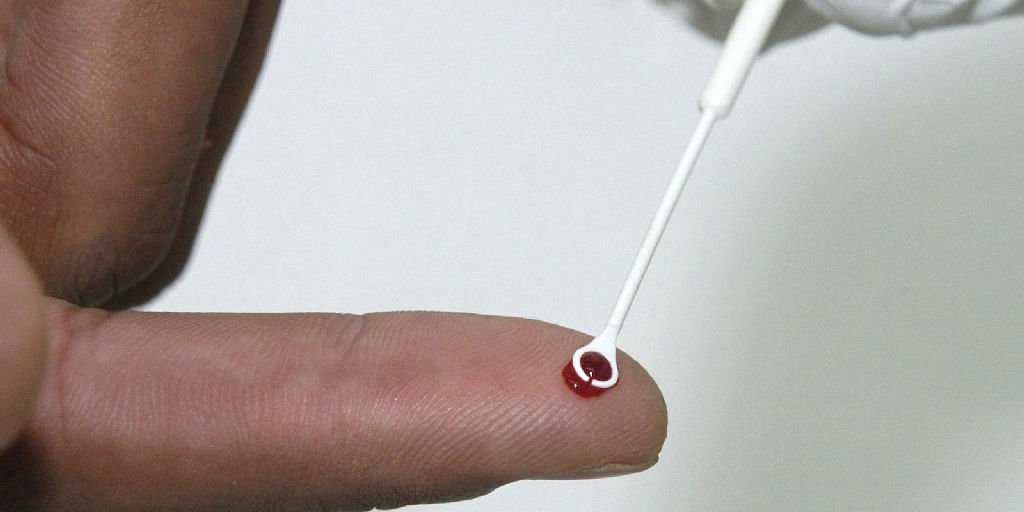 Fiji em Alerta Máximo: Crescimento Alarmante de Casos de HIV Leva à Emergência Nacional