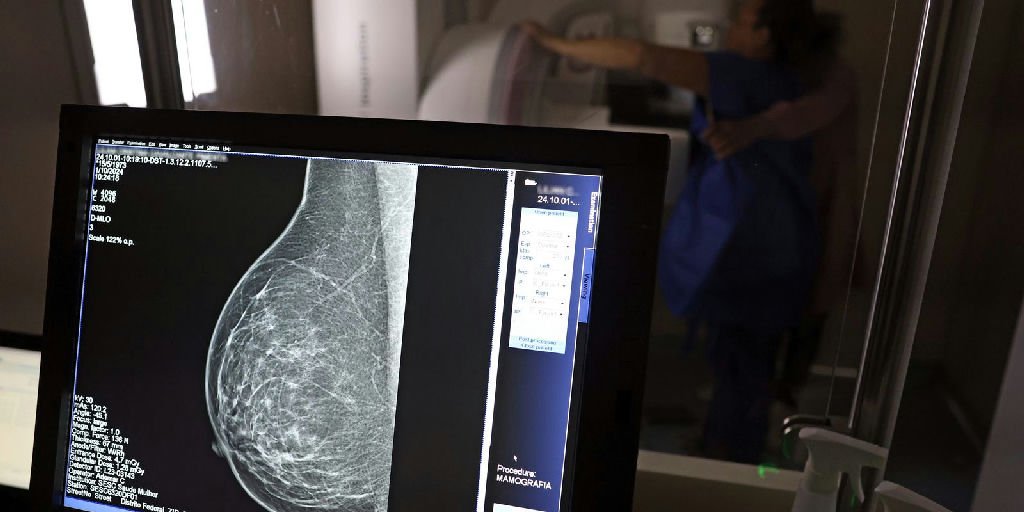 Planos de saúde ampliam cobertura de mamografia digital para todas as idades