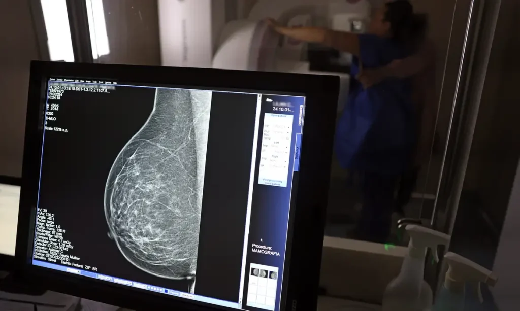 Guia médico padroniza pedidos para barrar recusa de mamografia digital por planos