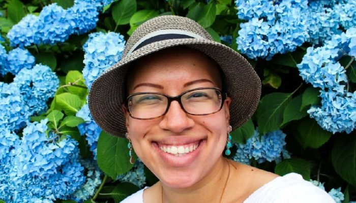 Alopecia areata: a jornada de pacientes em busca da autoestima e aceitação