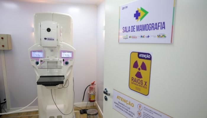 Demanda por cirurgias de mama no SUS dispara 54% em uma década