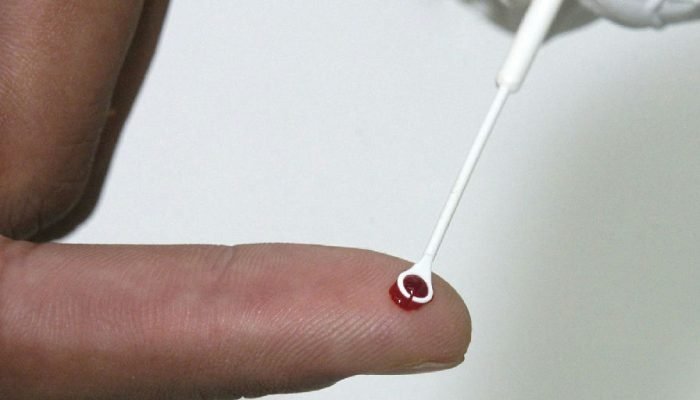 Fiji em Alerta Máximo: Crescimento Alarmante de Casos de HIV Leva à Emergência Nacional