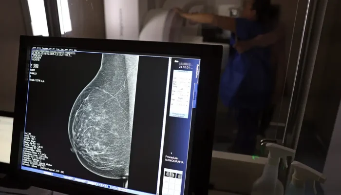 Guia médico padroniza pedidos para barrar recusa de mamografia digital por planos