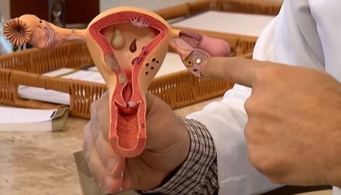 Investimento de R$ 60 milhões impulsiona pesquisas sobre endometriose e saúde menstrual no Brasil