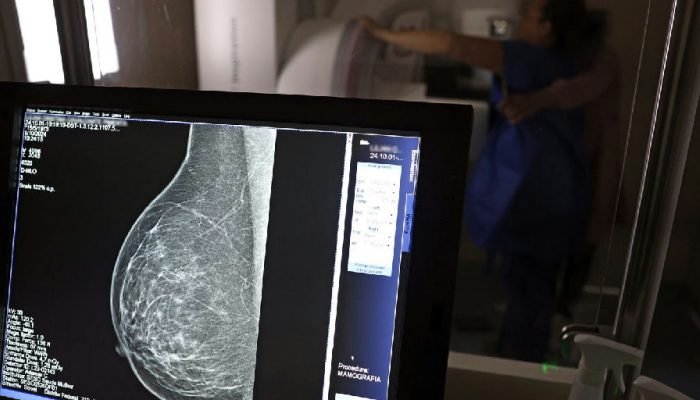Planos de saúde ampliam cobertura de mamografia digital para todas as idades